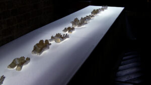 Annita Argyroiliopoulou Prothesis