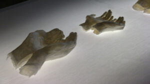 Annita Argyroiliopoulou Prothesis